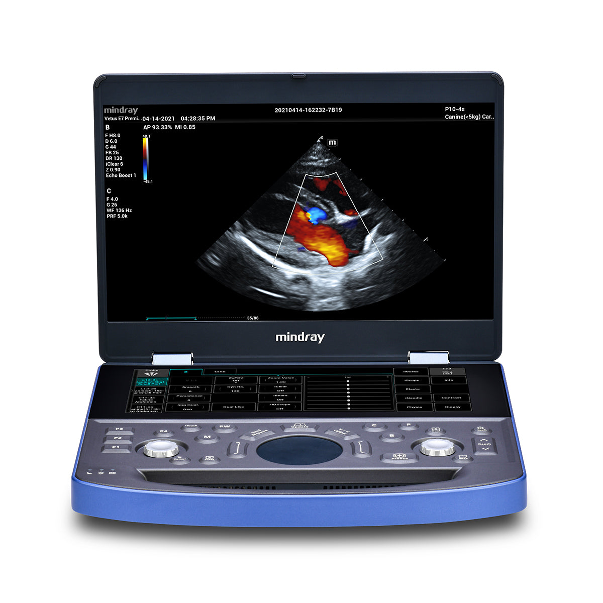 Ultrasonido Mindray Vetus E7 Básico