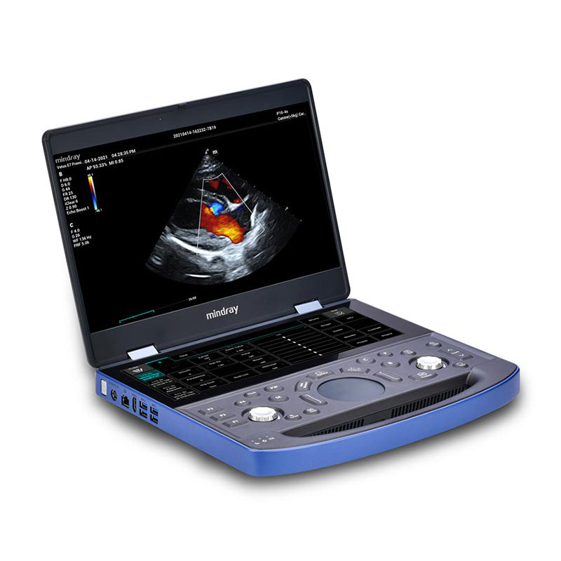 Ultrasonido Mindray Vetus E7 Básico